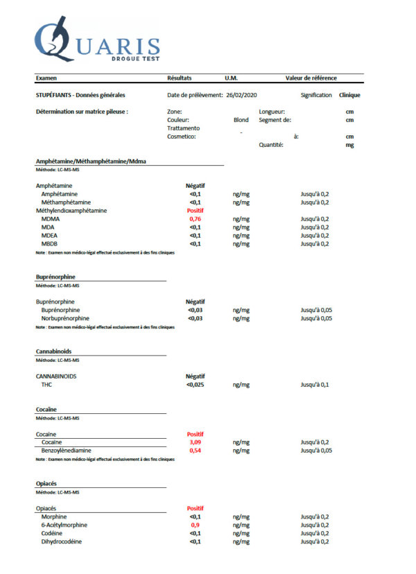 Exemple de résultat de l’analyse du cheveu  Quaris Drogue Test